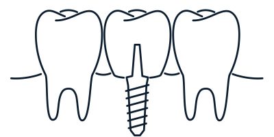 implant - the dental studio